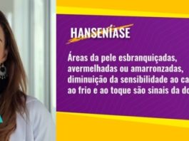 Miss Brasil Mundo 2018, Jéssica Carvalho traz um recado importante sobre a hanseníase