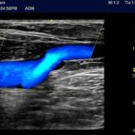 43db2a35-390f-44e0-ac0c-09abbe6be8b5