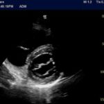 4f7df1c2-a0cf-4c65-ab9a-15ba333e6b8d