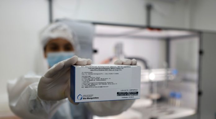 Pernambuco inicia diagnóstico laboratorial da monkeypox