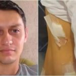 Jovem é esfaqueada no útero por ex inconformado com término