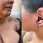 Esposa de Cleber Quequê esclarece sobre o que aconteceu na noite de sábado quando o homem teve 90% do corpo queimado