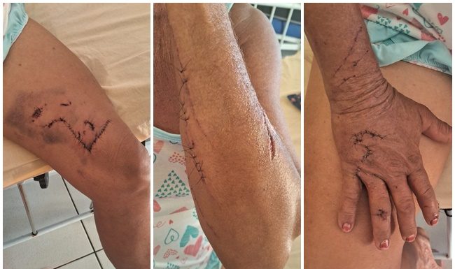 Onça ataca senhora em Carnaubeira da Penha; familiares cobram providências das autoridades